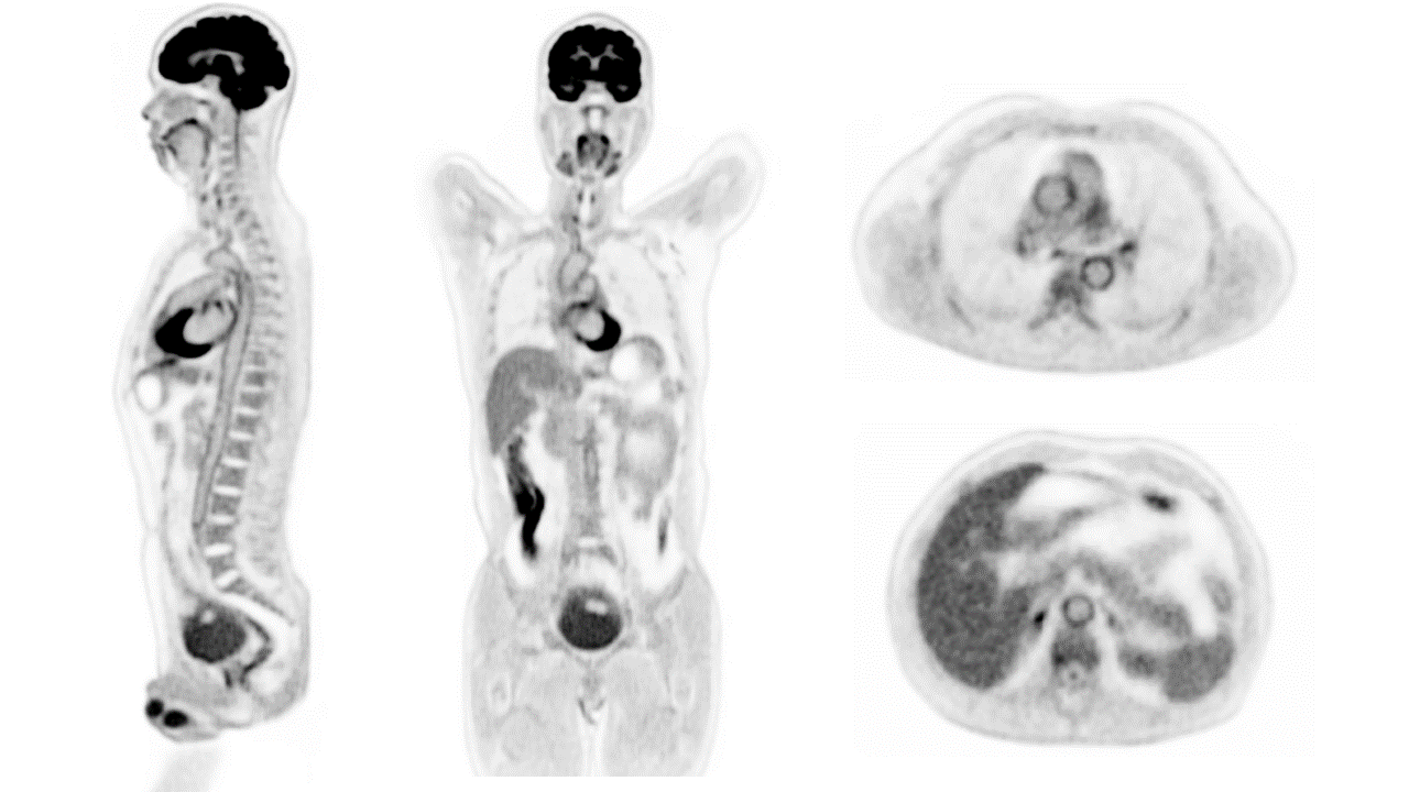 EXPLORER PET/CT images