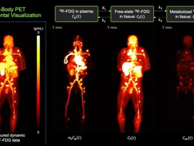 TotalBodyPetCompartmentalVisualization